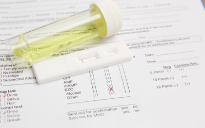 3 common drug testing methods that can be used for your new employees